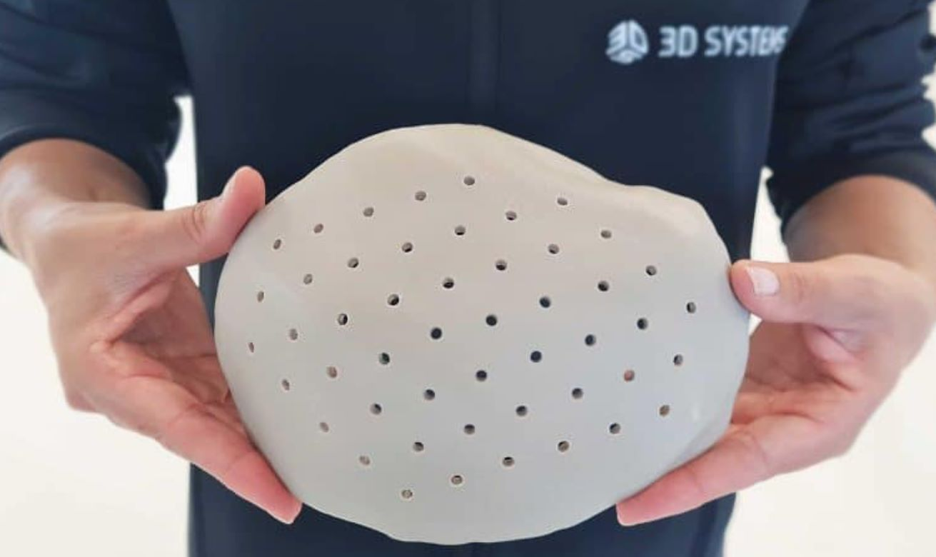 FDA已批准3D Systems 3D打印患者特定的 VSP PEEK 颅骨植入解决方案