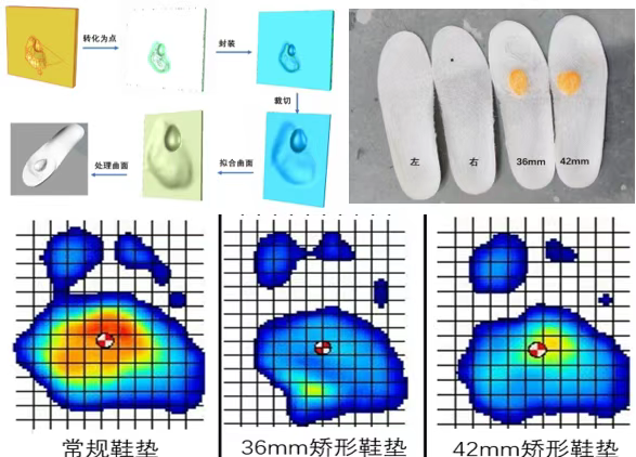 瑞金骨科研究所如何利用 3D Systems 增材制造解决方案构建个性化矫形器和导板的工作流程