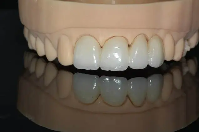 3D Systems助力客户携手打造口腔健康创新产品